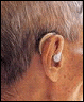 Hearing Care Discount Plan
